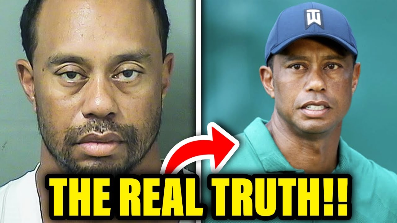 Is This Why Tiger Woods Looks Different? Surgery Secrets